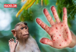 Viruela del mono en Perú: casos se elevan a 1128 y enfermedad se reporta en 16 regiones Viruela del mono en Perú: casos se elevan a 1128 y enfermedad se reporta en 16 regiones