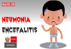 Neumonía y encefalitis genera el sarampión en niños y niñas no vacunadas Neumonía y encefalitis genera el sarampión en niños y niñas no vacunadas