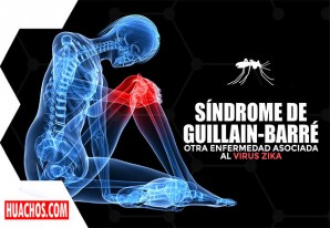 MINSA declara alerta de salud por 19 probables casos de Síndrome Guillain-Barré MINSA declara alerta de salud por 19 probables casos de Síndrome Guillain-Barré