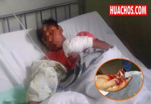 Niño pierde tres dedos de la mano al detonar cohetón que encontró en la calle Niño pierde tres dedos de la mano al detonar cohetón que encontró en la calle