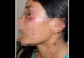 La violencia familiar o conyugal es un serio problema social en Huancavelica La violencia familiar o conyugal es un serio problema social en Huancavelica